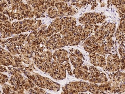 Sino Biological S100B Antibody, Mouse MAb 100uL, Quantity: Each of 1