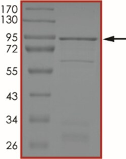 Sino Biological&nbsp;Recombinant Human Smad2 Protein (Full Length, GST Tag)