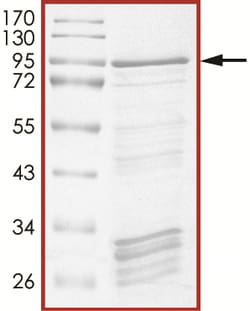Sino Biological&nbsp;Recombinant Human Smad4 Protein (Full Length, GST Tag)