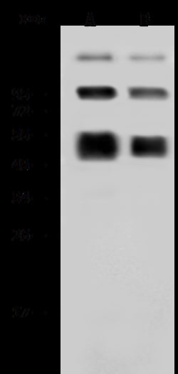 Sino Biological Dengue virus (DENV) (type 2, strain New Guinea C) NS1 Antibody,