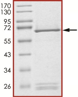 Sino Biological&nbsp;Recombinant Human SMYD3 Protein (Full Length, GST Tag), Active