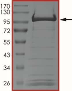 Sino Biological&nbsp;Recombinant Human SIRT1 Protein (GST Tag), Active