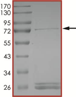 Sino Biological&nbsp;Recombinant Human KMT1A/SUV39H1 Protein (Full Length, GST Tag), Active