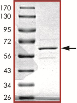 Sino Biological&nbsp;Recombinant Human SIRT2 Protein (Full Length, GST Tag)