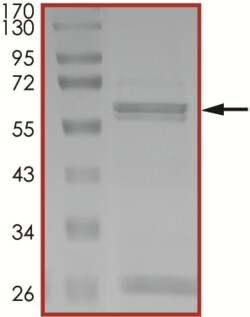 Sino Biological&nbsp;Recombinant Human SIRT4 Protein (Full Length, GST Tag)