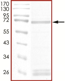 Sino Biological&nbsp;Recombinant Human TSSK1B Protein (Full Length, GST Tag), Active