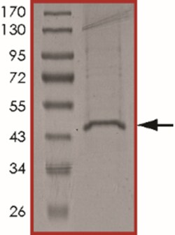 Sino Biological&nbsp;Recombinant Human SIRT7 Protein (Full Length, His Tag), Active