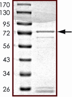 Sino Biological&nbsp;Recombinant Human STK25 Protein (Full Length, GST Tag)