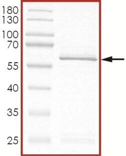 Sino Biological&nbsp;Recombinant Human STYK1/NOK Protein (GST Tag)