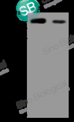 Sino Biological SARS-CoV Spike S1 Subunit Antibody, Mouse MAb 100uL, Quantity: