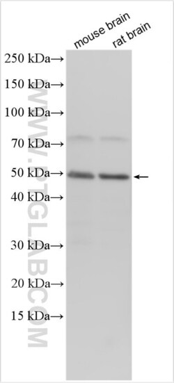 SCN3B Rabbit, anti-Human, Polyclonal, Proteintech Quantity: 150 &mu;L:Antibodies