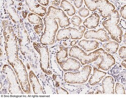 Sino Biological Anti-SDHB Antibody, Rabbit Polyclonal, Quantity: Each of