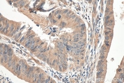 SEMA4B Rabbit, anti-Human, Polyclonal, Proteintech Quantity: 150 &mu;L:Antibodies
