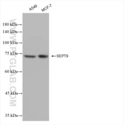 SEPT9 Rabbit, anti-Human, Clone: 20000000, Proteintech Quantity: 100 &mu;L:Antibodies