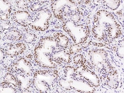 Sino Biological Anti-SET Antibody, Rabbit Polyclonal, Quantity: Each of