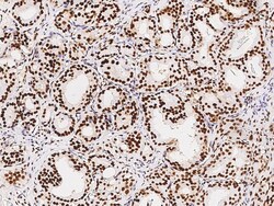Sino Biological SET Antibody, Rabbit PAb, Antigen Affinity Purified 100uL,