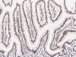 Sino Biological Anti-Sin3a Antibody, Rabbit Polyclonal, Quantity: Each