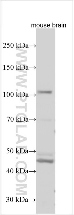 SLC14A2 Rabbit, anti-Human, Polyclonal, Proteintech Quantity: 150 &mu;L:Antibodies