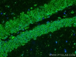 SLC25A22 Rabbit, anti-Human, CoraLite Plus 488, Polyclonal, Proteintech