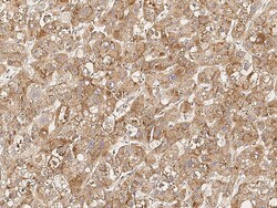 Sino Biological Anti-SLC27A5 Antibody, Rabbit Polyclonal, Quantity: Each
