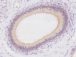 Sino Biological SLC6A18 Antibody, Rabbit PAb, Antigen Affinity Purified