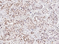 Sino Biological Anti-Smad5 Antibody, Rabbit Polyclonal, Quantity: Each