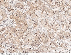 Sino Biological SMG1 Antibody, Rabbit PAb, Antigen Affinity Purified 100uL,