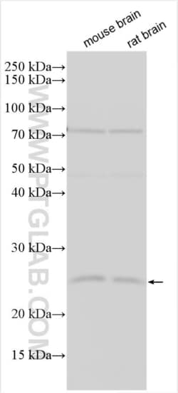SNX10 Rabbit, anti-Human, Polyclonal, Proteintech Quantity: 150 &mu;L:Antibodies