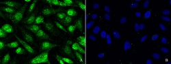Sino Biological Anti-SOCS1 Antibody, Rabbit Polyclonal, Quantity: Each