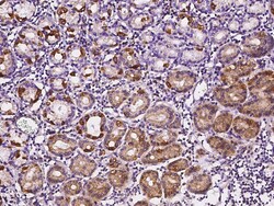 Sino Biological Anti-SOCS4 Antibody, Rabbit Polyclonal, Quantity: Each