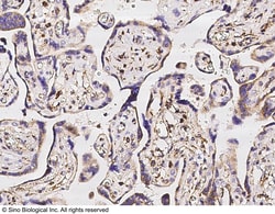 Sino Biological SOD2 Antibody, Rabbit MAb 100uL, Quantity: Each of 1