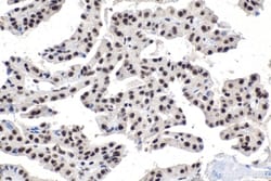 SON Rabbit, anti-Human, Polyclonal, Proteintech Quantity: 150 &mu;L:Antibodies