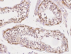 Sino Biological Anti-Src Antibody, Rabbit Polyclonal, Quantity: Each of