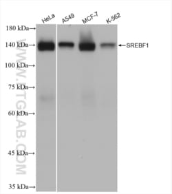 SREBF1 Rabbit, anti-Human, Clone: 1P4, Proteintech Quantity: 20 &mu;L:Antibodies