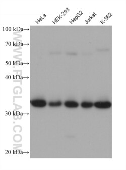 Spermidine synthase Mouse, anti-Human, Clone: 2F4E10, Proteintech:Antibodies:Primary