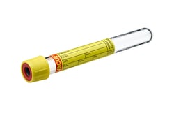 VACUETTE™ Urine STB Tube