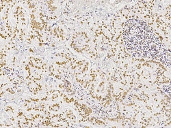Sino Biological STK4 / MST1 Antibody, Rabbit MAb 100µL, Quantity: Each