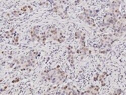 Sino Biological Anti-KMT1B/SUV39H2 Antibody, Rabbit Polyclonal, Quantity: