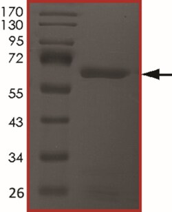 Sino Biological&nbsp;Recombinant Human TIE-2 Protein (P883A, GST Tag), Active