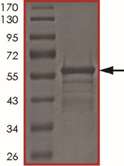 Sino Biological&nbsp;Recombinant Human Tau Protein (Tau-410)