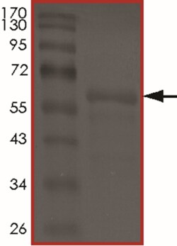 Sino Biological&nbsp;Recombinant Human Tau Protein (Tau-441 (dN296))