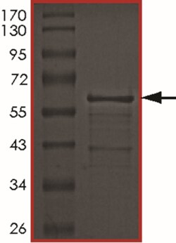 Sino Biological&nbsp;Recombinant Human Tau Protein (Tau-441 (S199E))