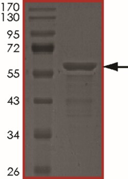 Sino Biological&nbsp;Recombinant Human Tau Protein (Tau-441)