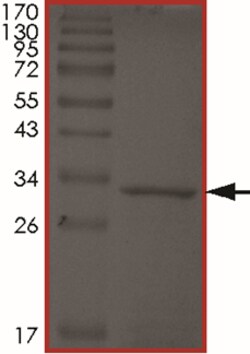 Sino Biological&nbsp;Recombinant Human Tau Protein (Tau-441)
