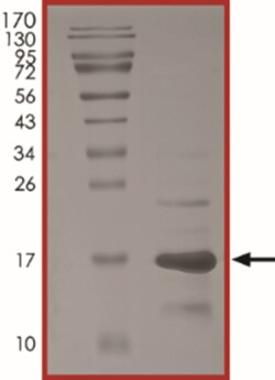 Sino Biological&nbsp;Recombinant Human Tau Protein (Tau-441, His Tag)