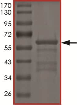 Sino Biological&nbsp;Recombinant Human Tau Protein (Tau-441 (P301L))