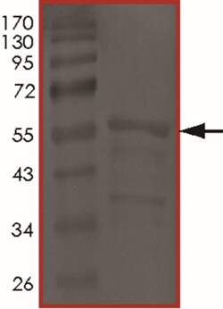 Sino Biological&nbsp;Recombinant Human Tau Protein (Tau-441 (S305N))