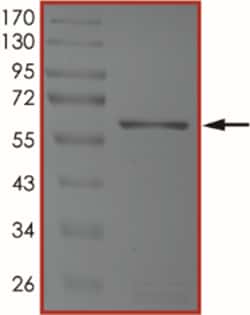 Sino Biological&nbsp;Recombinant Human TAOK1 Protein (GST Tag), Active