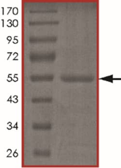 Sino Biological&nbsp;Recombinant Human TP53RK Protein (Full Length, GST Tag)