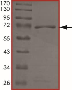 Sino Biological&nbsp;Recombinant Human TRIB1 Protein (Full Length, GST Tag)